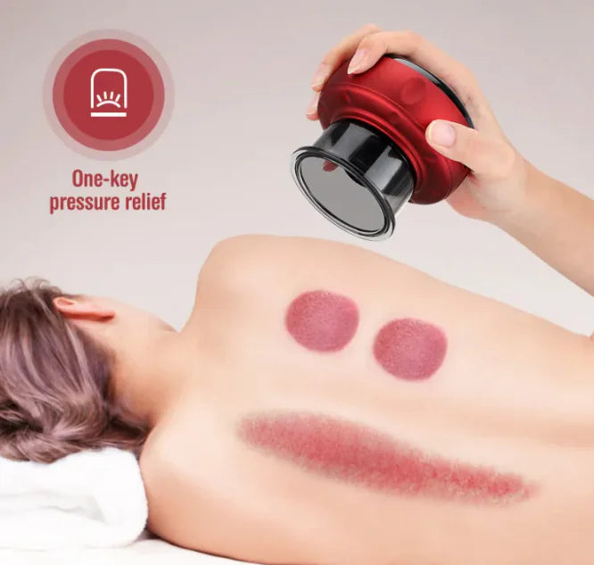 Electric Cupping Massager